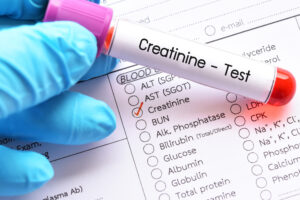 CREATININE