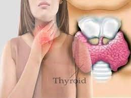 THYROID TEST