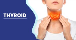 TREAT THYROID