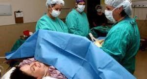 CESAREAN