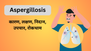 Aspergillosis