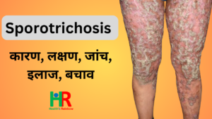 Spirotrichosis