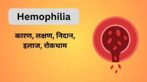 hemophilia